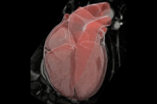 Discretized geometry of a heart with MRI